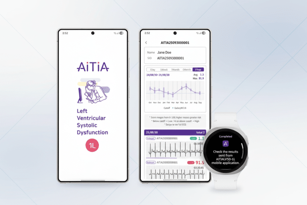 A 16:9 aspect ratio image showing two smartphones and a smartwatch displaying medical application interfaces. The left smartphone shows the AiTiA Left Ventricular Systolic Dysfunction 1L app. The right smartphone displays a patients medical data with graphs and scores. The smartwatch shows a Completed notification from the AiTiA app.