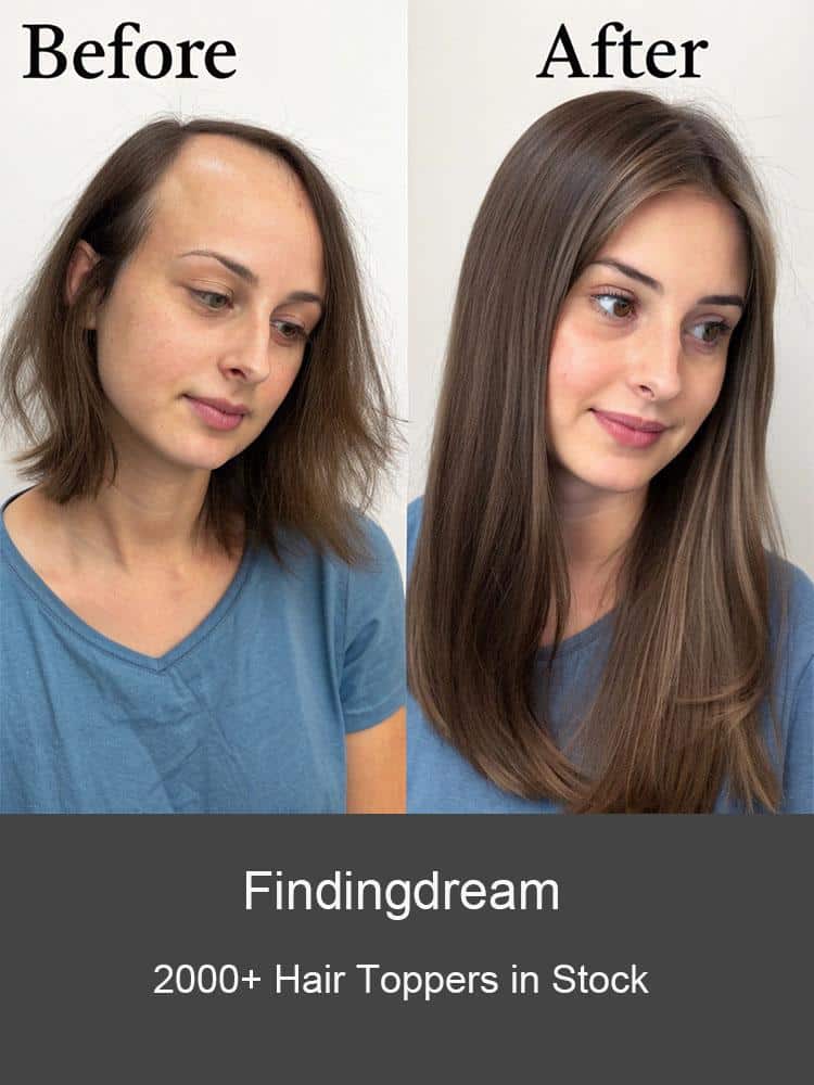 Image 1 of How to Choose Wigs or Hair Toppers for thinning hair