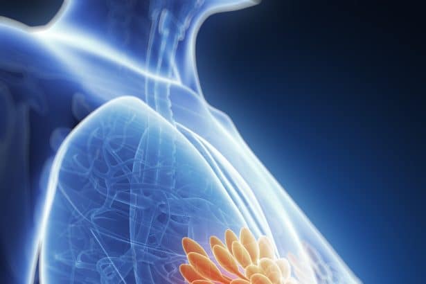 Image 1 of While the idea of a mastectomy may be daunting in the beginning, most patients take comfort in knowing that it can remove their cancer and lessen the chances of recurrence.